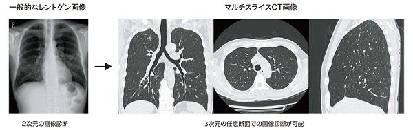 診断装置のご案内